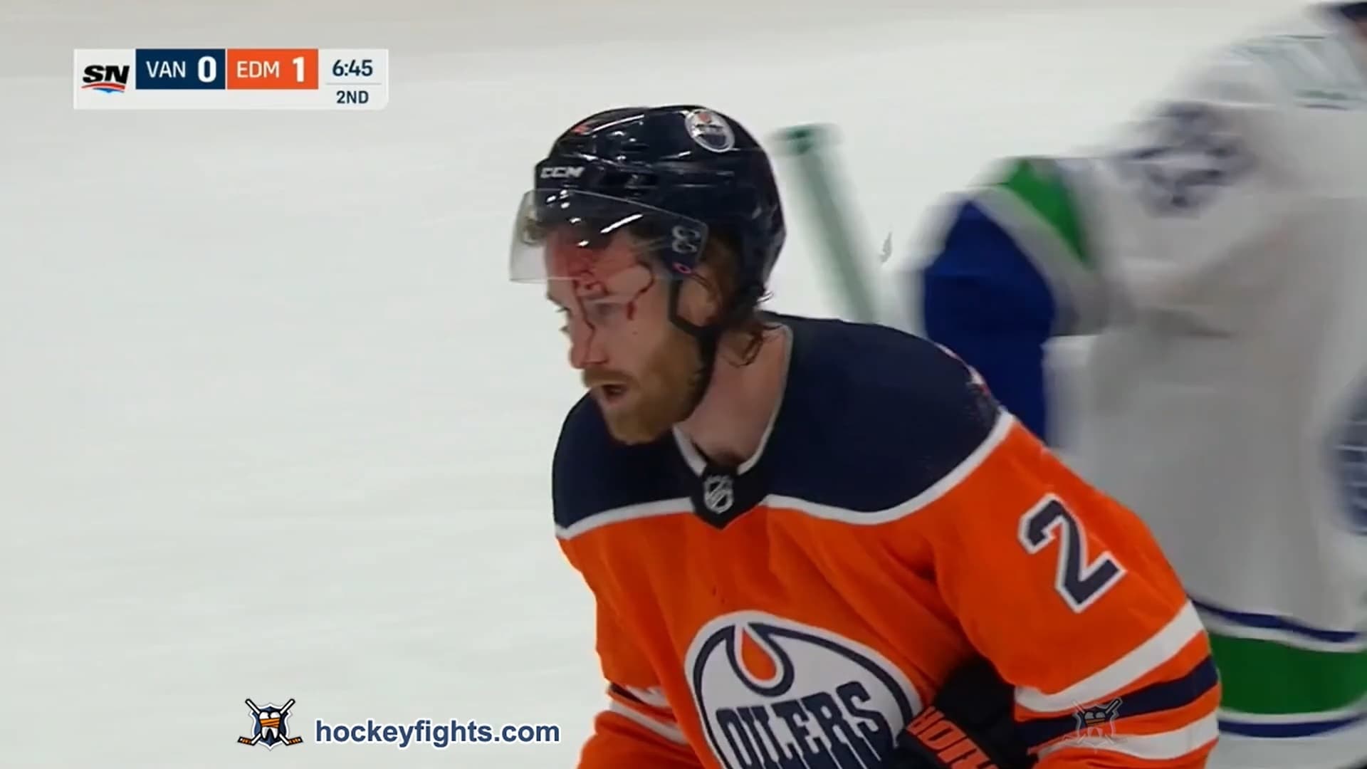 T. Myers (VAN) vs. C. Sceviour (EDM)